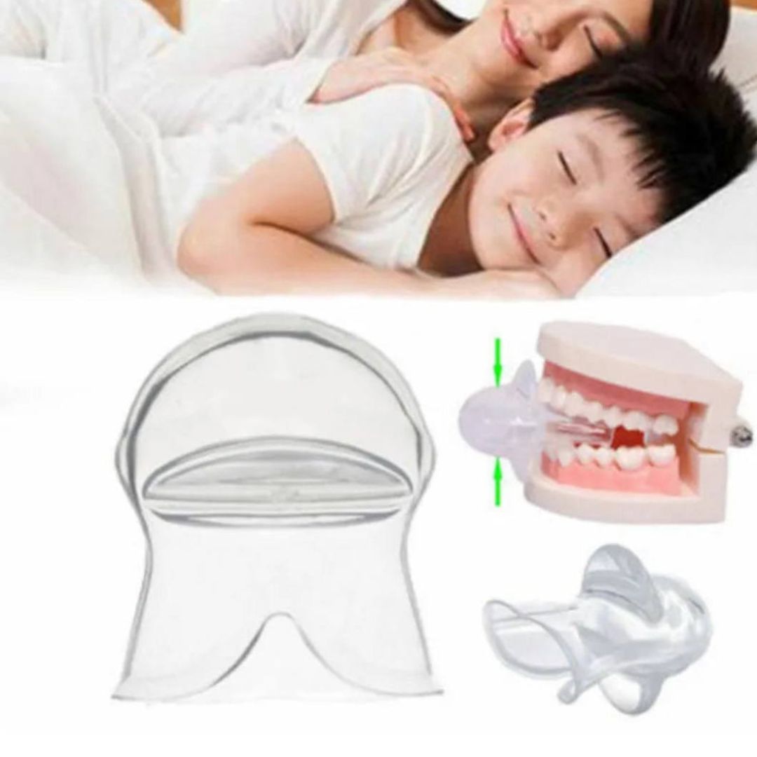 SnoreFree Mouthpiece